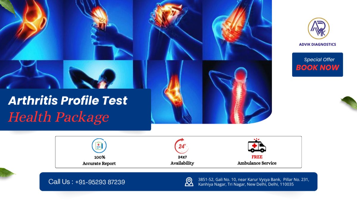 Arthritis Profile Test